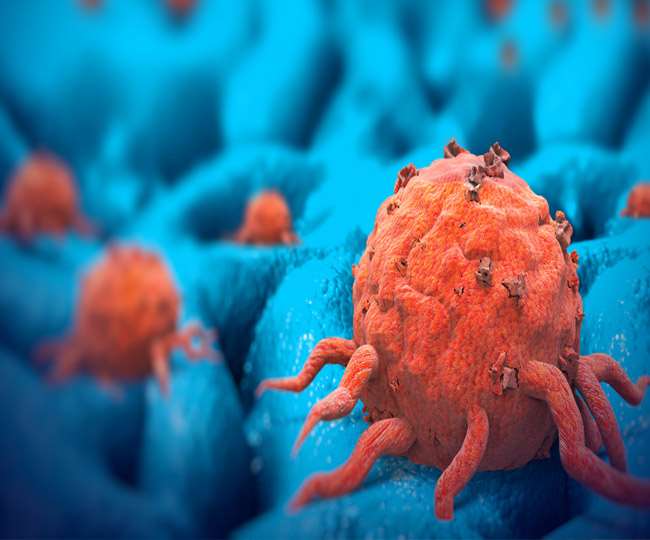 वैज्ञानिकों ने की टिश्‍यूज को कैंसर ग्रस्‍त करने वाले अहम प्रोटीन की पहचान, इलाज में मिलेगी मदद