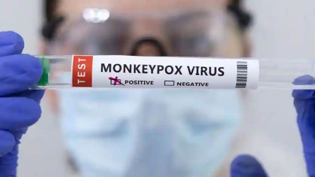 Monkeypox Hotspot: विश्‍व में मंकीपाक्‍स के मामलों में हाटस्‍पाट बन सकता है अमेरिका! दुनिया में 19 हजार के पार केस