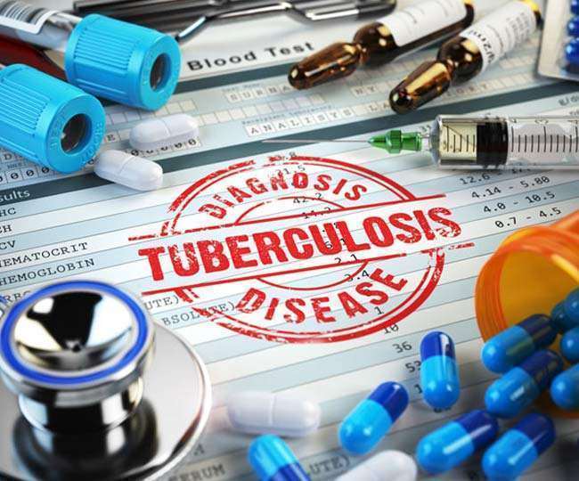 TB Patients: प्रयागराज में बनेंगे चार नए चिकित्सा केंद्र, ज्यादा से ज्यादा रोगियों का होगा इलाज