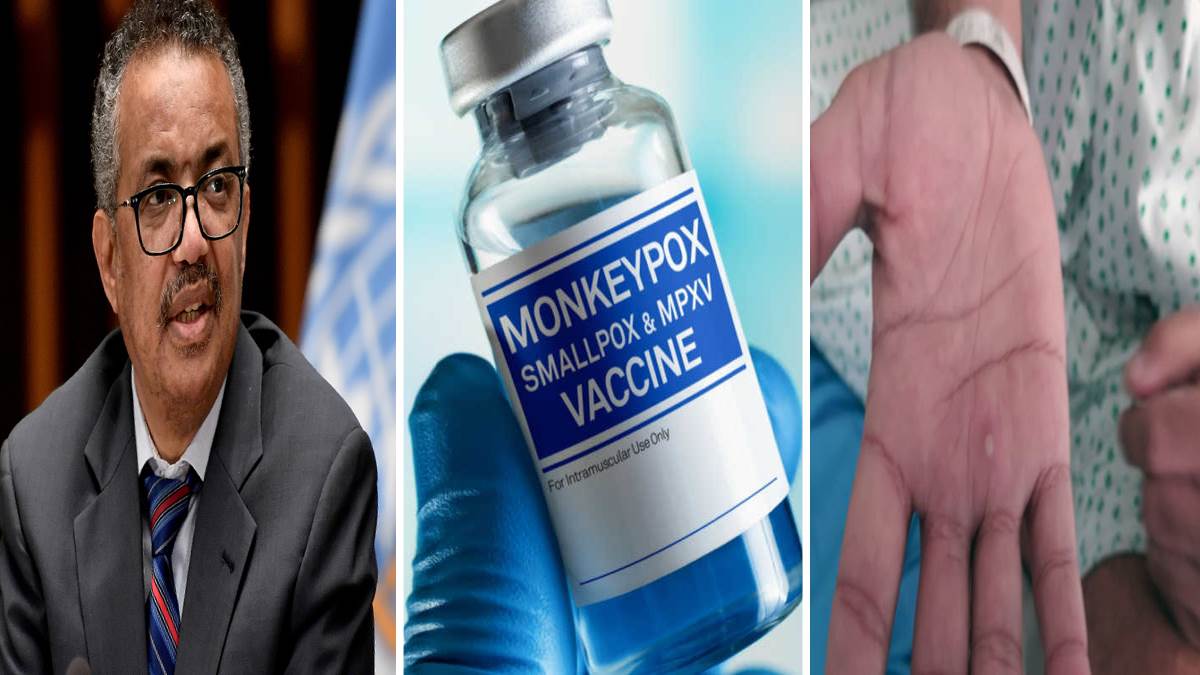 Facebook twitter wp MVA-BN Vaccine for Monkeypox: US, Canada और EU ने दी मंकीपाक्‍स वैक्‍सीन को मंजूरी, WHO ने दिया बड़ा बयान