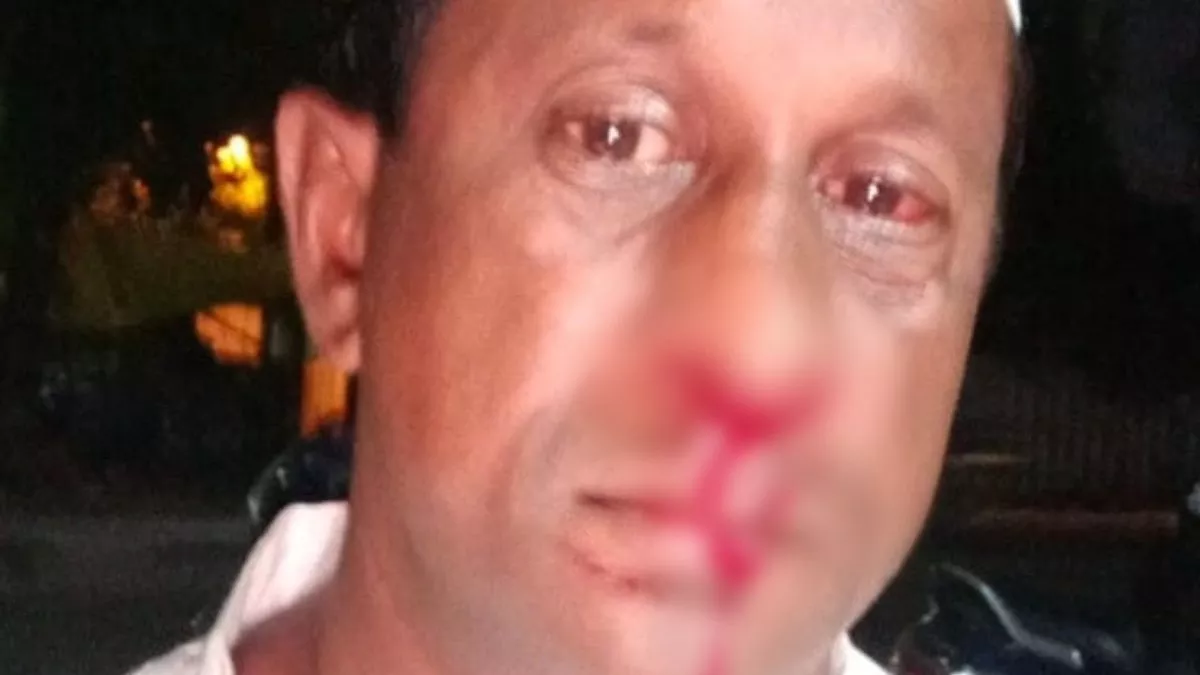 बिहार के बाद अब झारखंड में पत्रकार पर हमला, नमाज पढ़ने जा रहे अनवर शरीफ को पांच युवकों ने पीट-पीटकर किया घायल